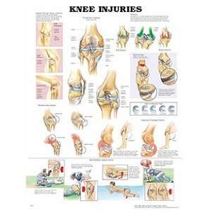 Anatomical Chart Company Knee Injuries Chart:  Industrial 