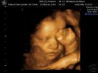 Our 4d baby scans pictures, pregnancy ultrasound scan items in WINDOW 