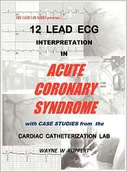 12 Lead Ecg Interpretation In Acute Coronary Syndrome With Case 