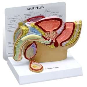 Male Pelvis w/ Testicular Cancer Anatomy Model #3570:  