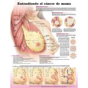   Cancer Chart (Spanish   Entendiendo el cancer de mama)   Laminated