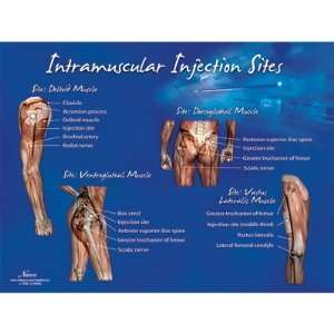 Intramuscular Injection Sites Chart