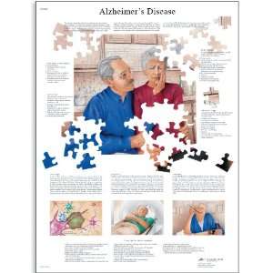 3B Scientific VR1628L Glossy Laminated Paper Alzheimers Disease 