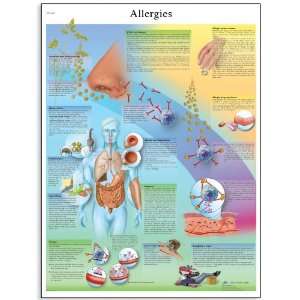 3B Scientific VR1660UU Glossy Paper Allergies Anatomical Chart, Poster 