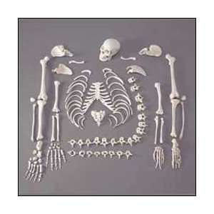Anatomical Chart Company   1/2 Disartic. Budget Skel w/Skull:  